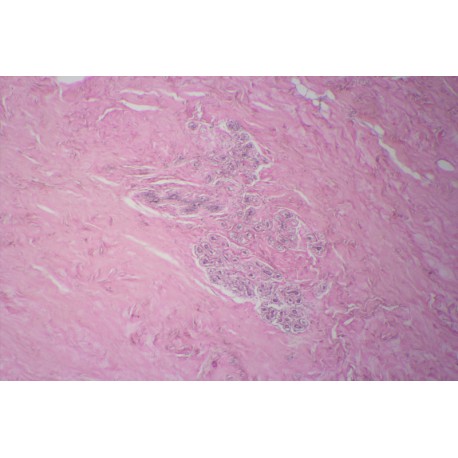 Mammary gland, resting, human t.s.