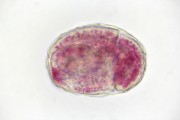 Fasciola hepatica cysticercus, w.m.