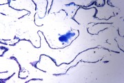 Leucosolenia, a simple marine sponge of the ascon type, stained and w.m.