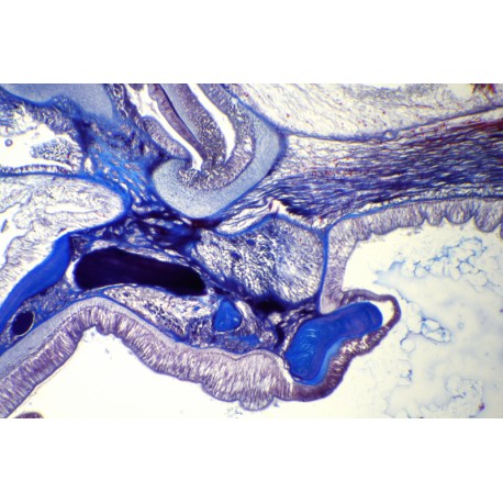 Balanoglossus, acorn worm, sagittal section of proto- and mesosoma *