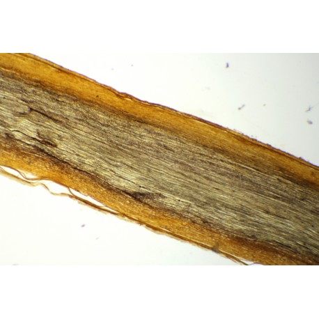 Myelinated nerve fiber of human t.s. and l.s. (silver staining)