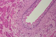 Transitional epithelium, sec