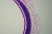 Pseudostratified ciliated columnar epithelium of human sec.