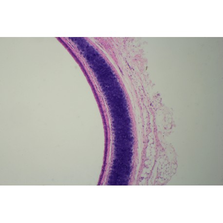 Pseudostratified ciliated columnar epithelium of human sec.