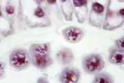 Development of the Microspore Mother Cells of Lilium candidum Slide Set