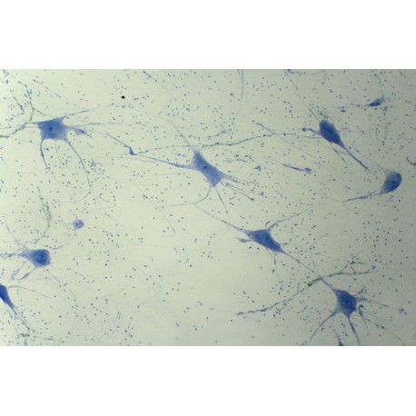 Nerve cells from spinal cord smear