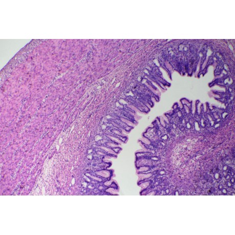 Human stomach pyloric region, c.s.