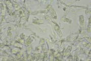 Powder bacteria (Erysiphe cichoracearum)