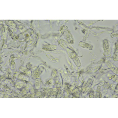 Powder bacteria (Erysiphe cichoracearum)