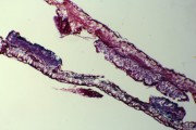 Coleosporium xanthoxyli