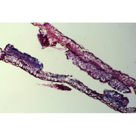 Coleosporium xanthoxyli