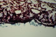 Colletotrichum (Colletotrichum gloesoporiodes penz)