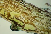 Cytospora carphosperma
