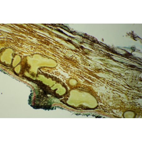 Cytospora carphosperma