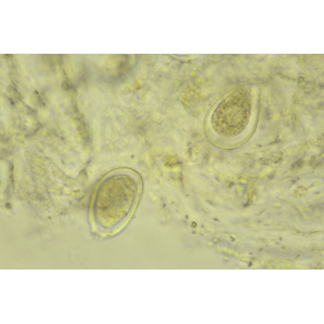 Phytophthora capsici (asexual)