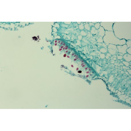 Puccinia allii (garlic)