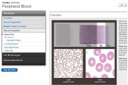 Peripheral Blood