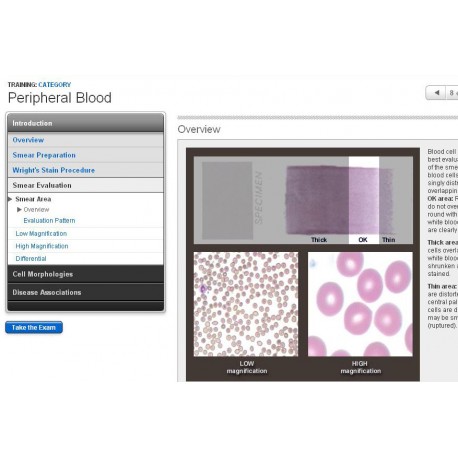 Peripheral Blood