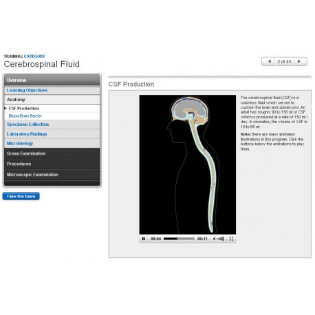 Cerebrospinal fluid