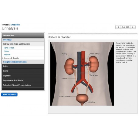 Urinalysis
