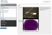 Gram Stain