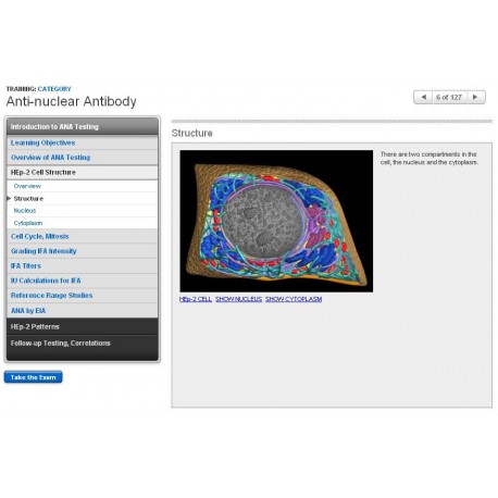 Anti-nuclear Antibody
