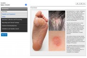 Skin KOH