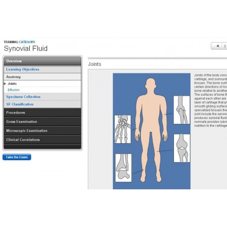 Synovial Fluid