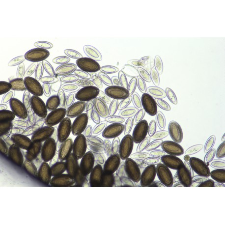 Eggs of macracanthorhychus hirudinaceus w.m. (natural color)
