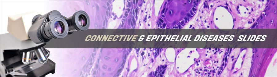 Connective & Epithelial Diseases Slides