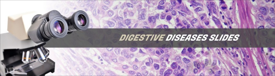 Digestive Diseases Slides