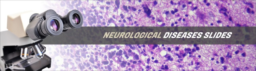 Neurological Diseases Slides